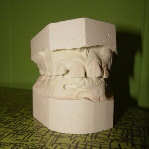 Vintage Irregular Teeth Impression plaster tooth casting dental oddity curiosity